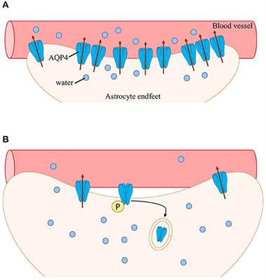 Mechanisms Underlying Aquaporin-4 Subcellular Mislocalization in Epilepsy